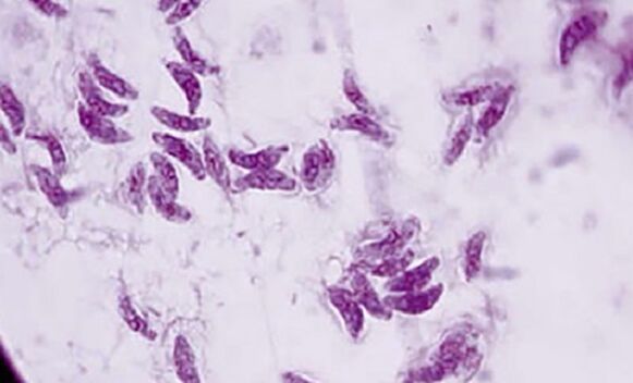 parasitic protozoan toxoplasma gondii the causative agent of toxoplasmosis
