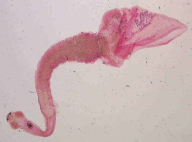 pork tapeworm from the human body