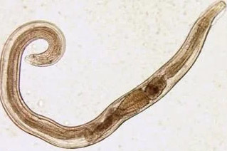 parasites humans pinworms